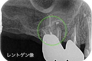 レントゲン検査