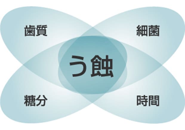 虫歯のメカニズム