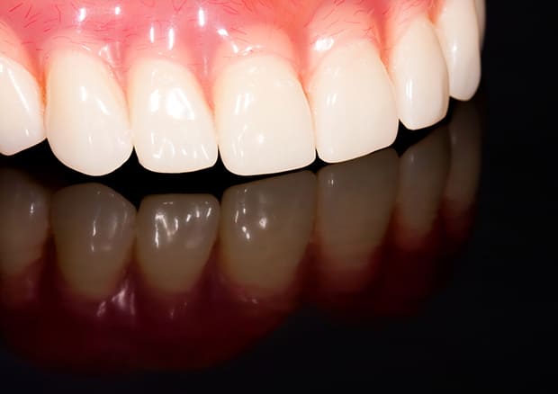 オーダーメイドの入れ歯