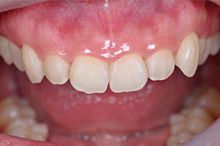 術前診査診断２