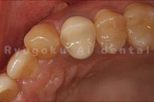 歯牙を精密にチェック