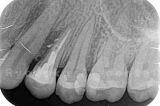 レントゲン検査