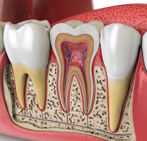 歯や歯髄を残す歯科治療