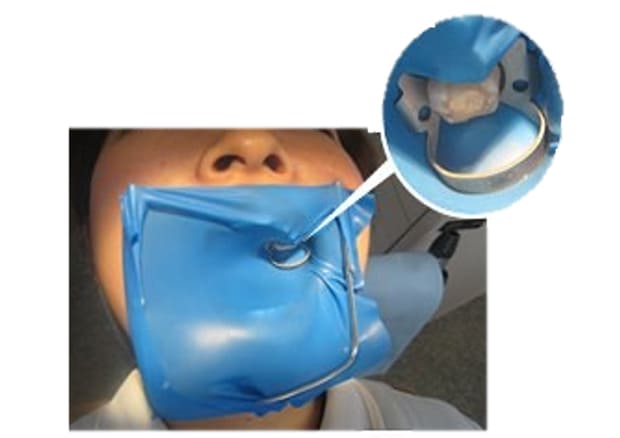 ラバーダムの使用<