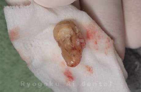 右上７番パーフォレーション