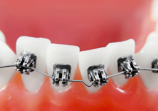 不正咬合による悪影響