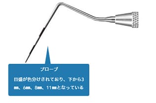 プローブで歯周ポケットの状態を確認